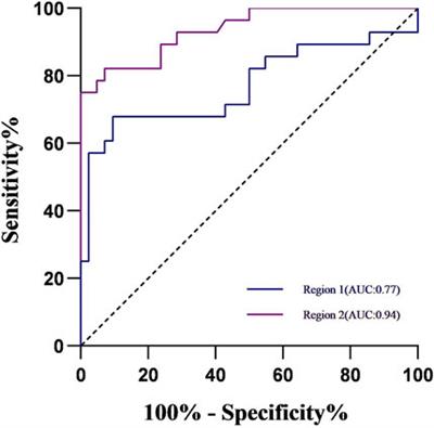 Subregional analysis of joint stiffness facilitates insight into ligamentous laxity after ACL injury